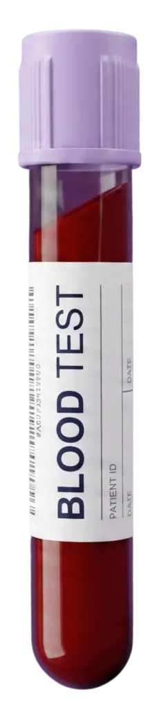 Pathology sample tube for blood work